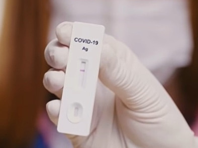 Screeningové testování